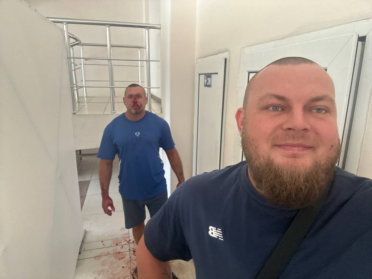 Разбитое лицо фитнес-тренера из Одессы, который послал и пожелал смерти украинским военным. Фото: телеграм